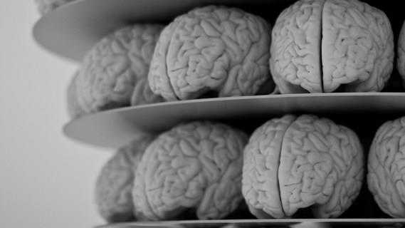 El cerebro comienza a comerlo mismo cuando no puede dormir